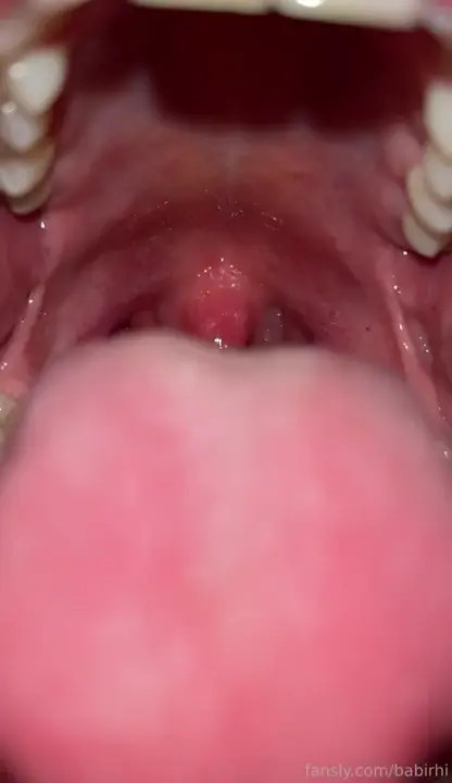 Babi Rhi Shows Her Uvula - ePornLeak